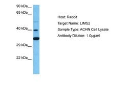 LIMS2 Rabbit anti-Human, Polyclonal, Novus Biologicals 0.1ml; Unconjugated:Antibodies,